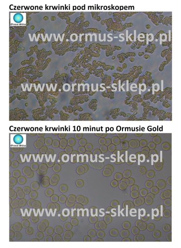 Czerwone krwinki-1.jpg